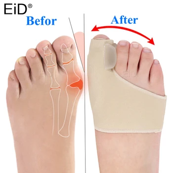 EiD 1 чифт Ортопедични Чорапи За Корекция на Палеца на Крака с голяма кост, Силиконови Чорапи За Педикюр, Коректор вальгусной деформация, Тиранти, Разделител за пръсти, Грижа За Краката
